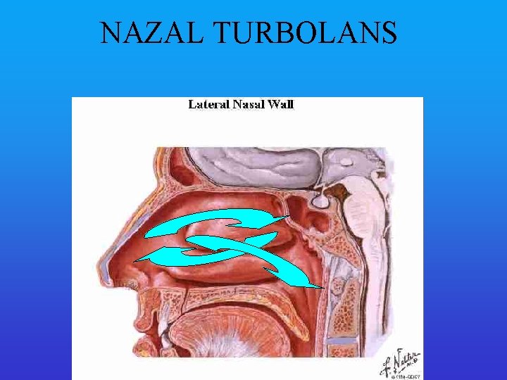 NAZAL TURBOLANS 