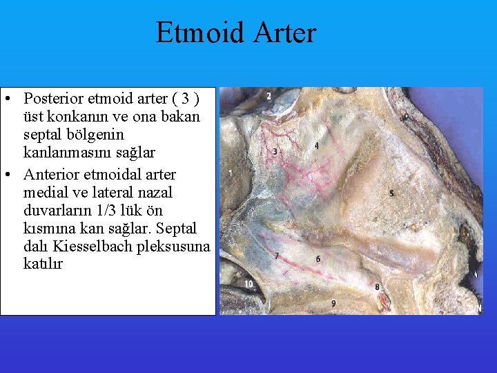 Etmoid Arter • Posterior etmoid arter ( 3 ) üst konkanın ve ona bakan