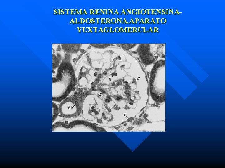 SISTEMA RENINA ANGIOTENSINAALDOSTERONA. APARATO YUXTAGLOMERULAR 