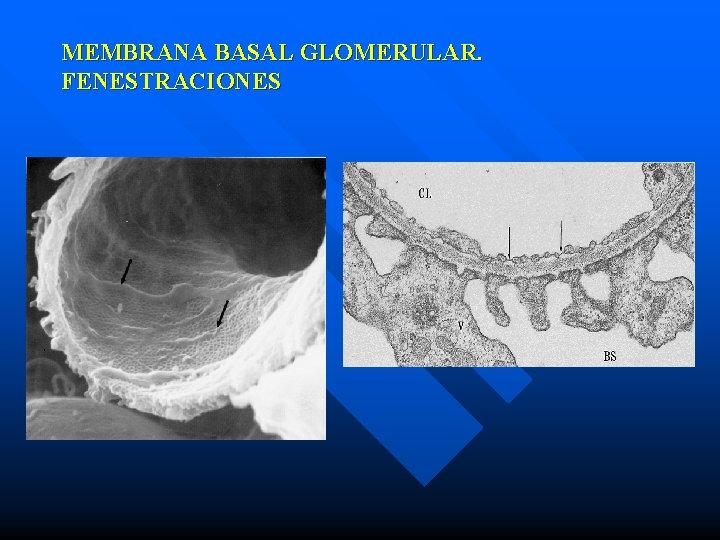 MEMBRANA BASAL GLOMERULAR. FENESTRACIONES 