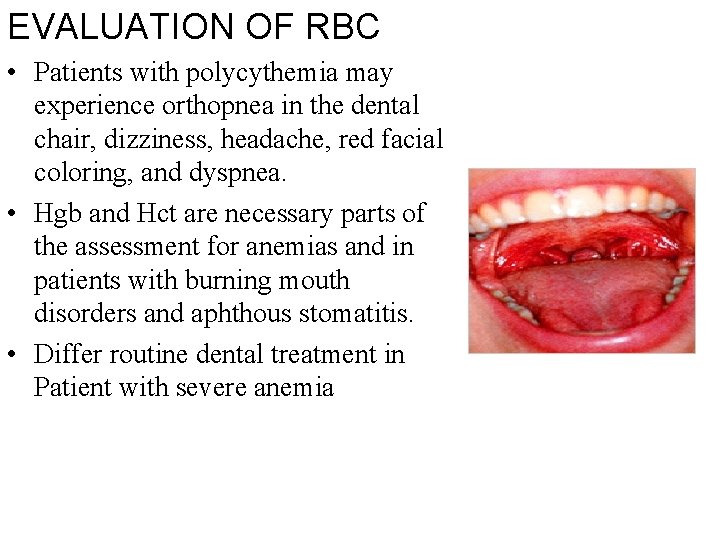 EVALUATION OF RBC • Patients with polycythemia may experience orthopnea in the dental chair,