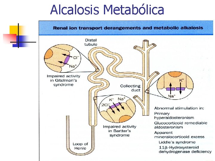Alcalosis Metabólica 