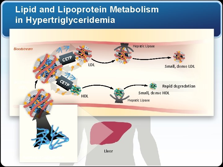 Lipid and Lipoprotein Metabolism in Hypertriglyceridemia Hepatic Lipase Bloodstream CETP Increased VLDL Small, dense