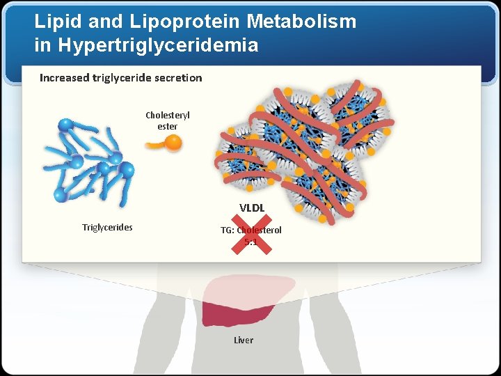 Lipid and Lipoprotein Metabolism in Hypertriglyceridemia Increased triglyceride secretion Cholesteryl ester VLDL Triglycerides TG: