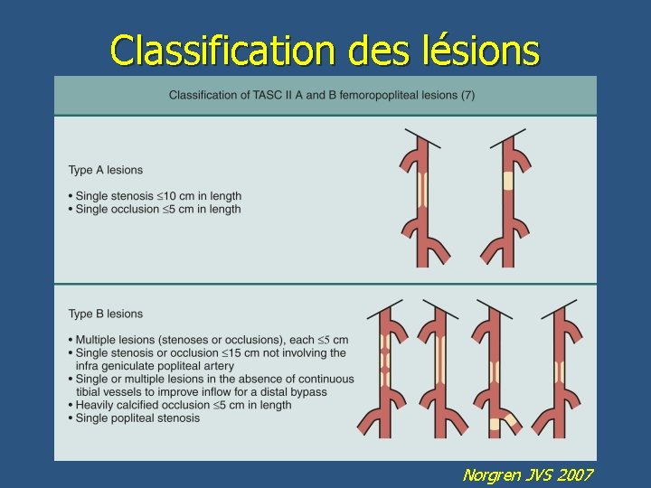 Classification des lésions Norgren JVS 2007 