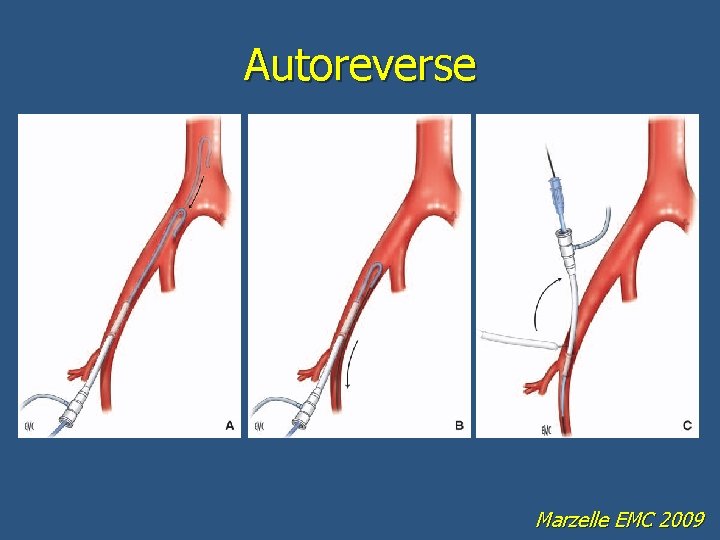 Autoreverse Marzelle EMC 2009 