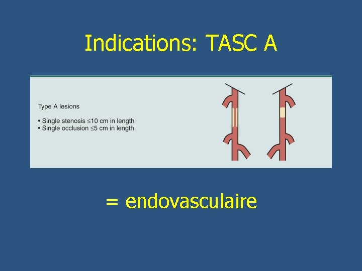 Indications: TASC A = endovasculaire 