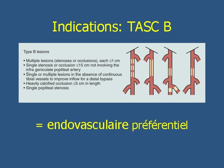 Indications: TASC B = endovasculaire préférentiel 