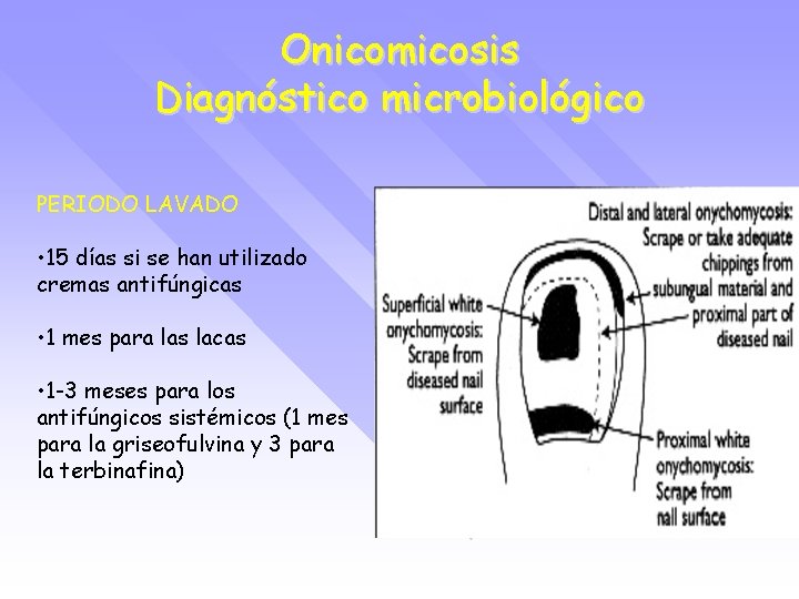 Onicomicosis Diagnóstico microbiológico PERIODO LAVADO • 15 días si se han utilizado cremas antifúngicas