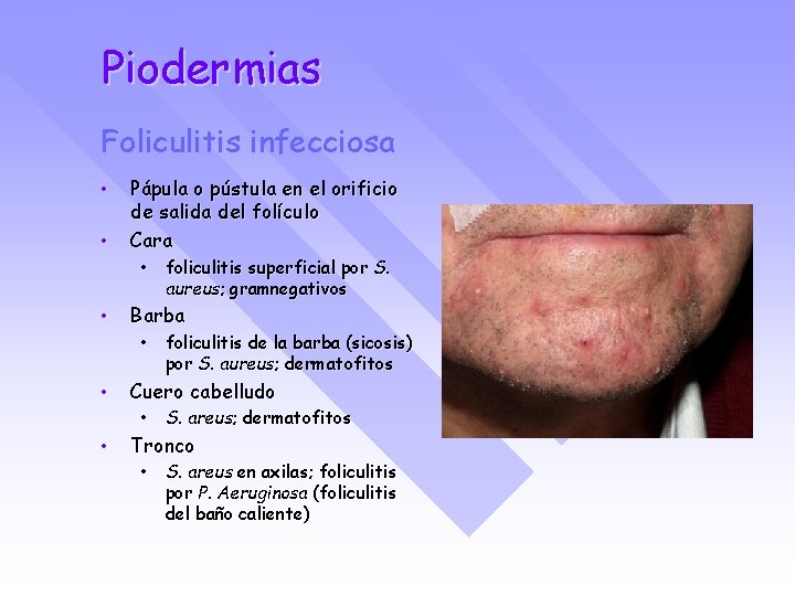 Piodermias Foliculitis infecciosa • • Pápula o pústula en el orificio de salida del
