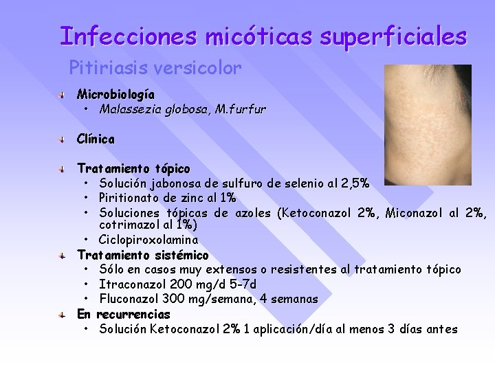 Infecciones micóticas superficiales Pitiriasis versicolor Microbiología • Malassezia globosa, M. furfur Clínica Tratamiento tópico