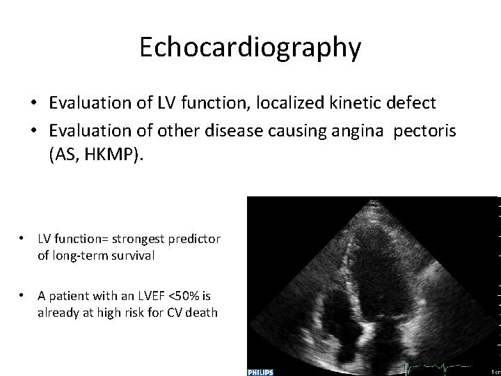 Echocardiography • Evaluation of LV function, localized kinetic defect • Evaluation of other disease