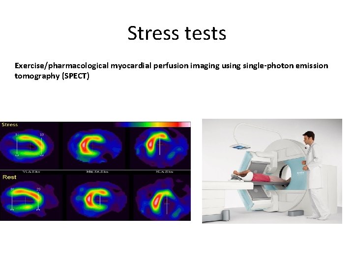 Stress tests Exercise/pharmacological myocardial perfusion imaging usingle-photon emission tomography (SPECT) 