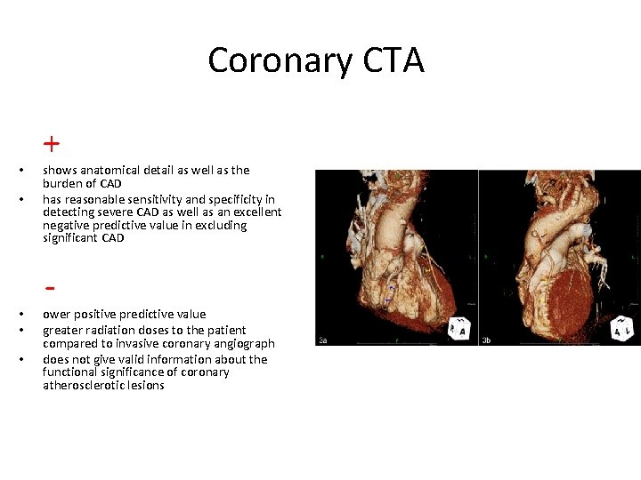 Coronary CTA + • • shows anatomical detail as well as the burden of