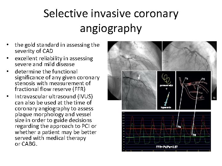 Selective invasive coronary angiography • the gold standard in assessing the severity of CAD