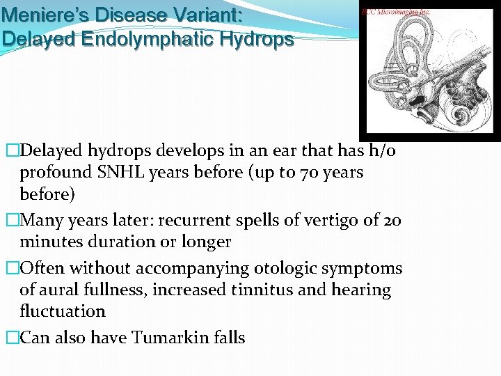 Meniere’s Disease Variant: Delayed Endolymphatic Hydrops �Delayed hydrops develops in an ear that has