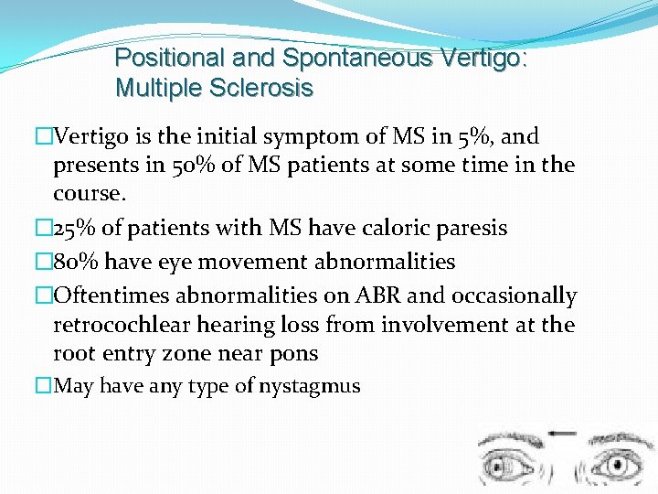 Positional and Spontaneous Vertigo: Multiple Sclerosis �Vertigo is the initial symptom of MS in
