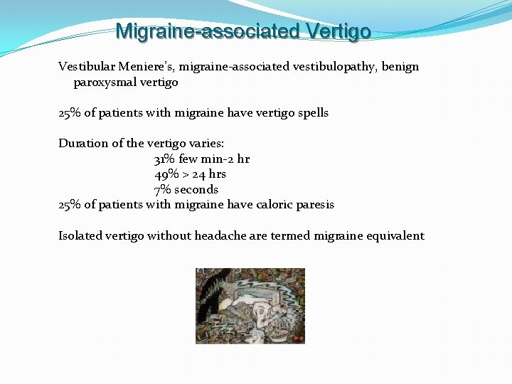 Migraine-associated Vertigo Vestibular Meniere’s, migraine-associated vestibulopathy, benign paroxysmal vertigo 25% of patients with migraine