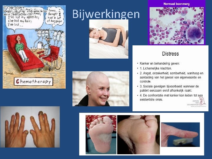 Bijwerkingen 