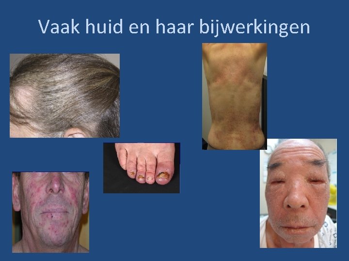 Vaak huid en haar bijwerkingen 