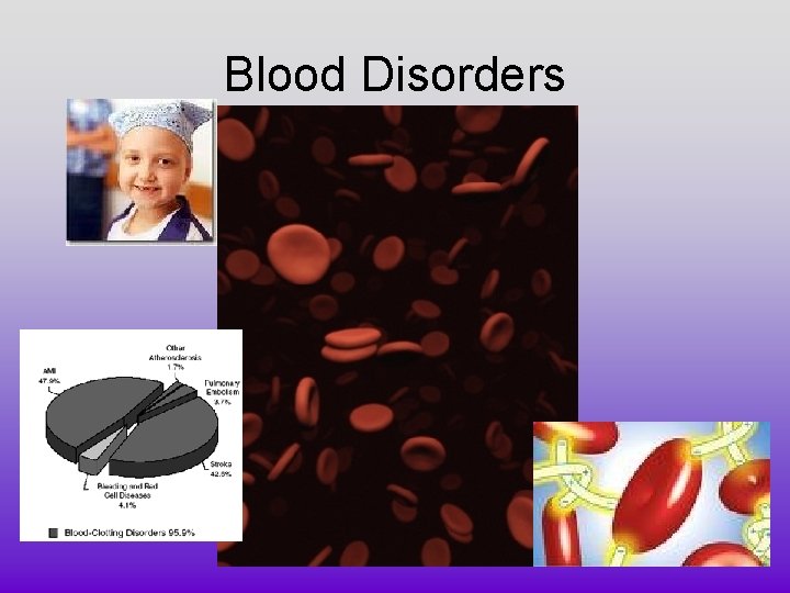Blood Disorders 
