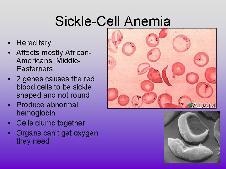 Sickle-Cell Anemia • Hereditary • Affects mostly African. Americans, Middle. Easterners • 2 genes Sickle-Cell Anemia • Hereditary • Affects mostly African. Americans, Middle. Easterners • 2 genes