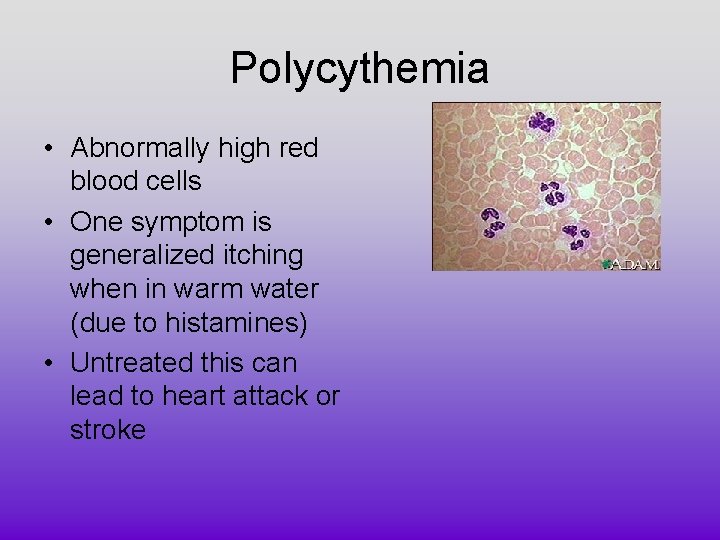 Polycythemia • Abnormally high red blood cells • One symptom is generalized itching when Polycythemia • Abnormally high red blood cells • One symptom is generalized itching when