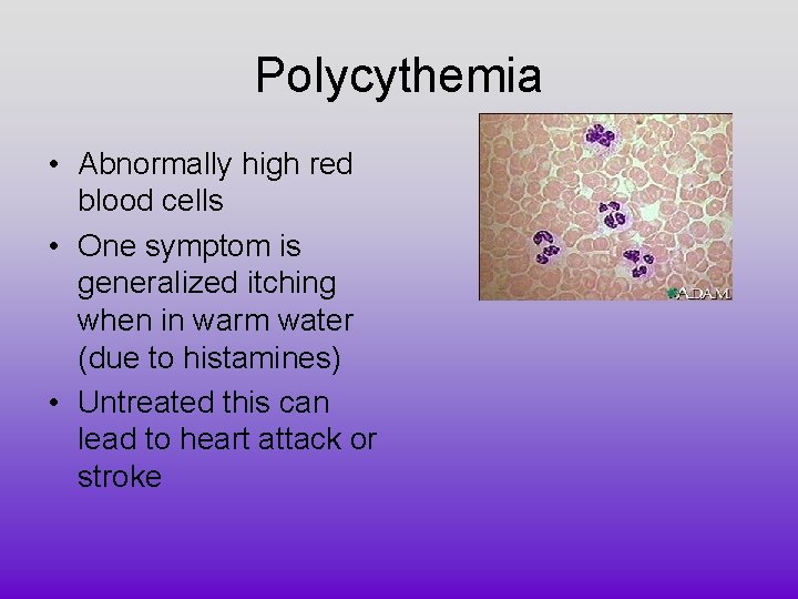 Polycythemia • Abnormally high red blood cells • One symptom is generalized itching when