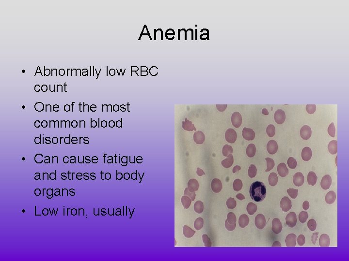 Anemia • Abnormally low RBC count • One of the most common blood disorders