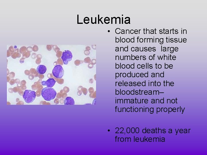 Leukemia • Cancer that starts in blood forming tissue and causes large numbers of