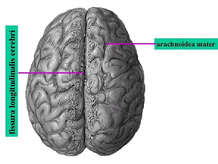 fissura longitudinalis cerebri arachnoidea mater fissura longitudinalis cerebri arachnoidea mater