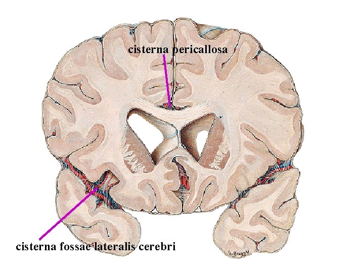 cisterna pericallosa cisterna fossae lateralis cerebri cisterna pericallosa cisterna fossae lateralis cerebri