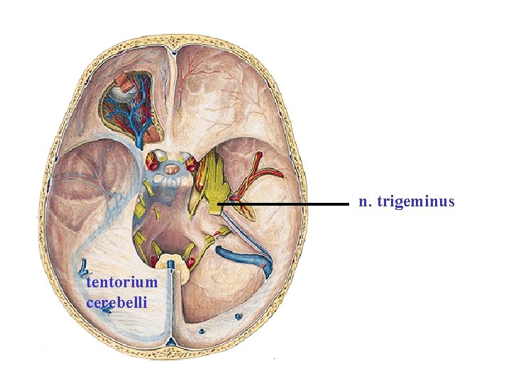 n. trigeminus tentorium cerebelli n. trigeminus tentorium cerebelli
