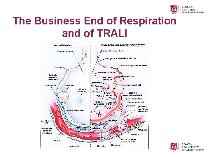 The Business End of Respiration and of TRALI 