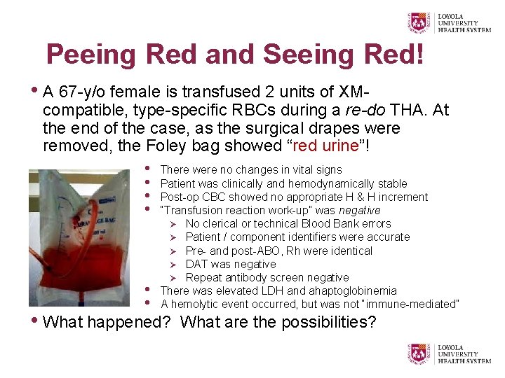 Peeing Red and Seeing Red! • A 67 -y/o female is transfused 2 units