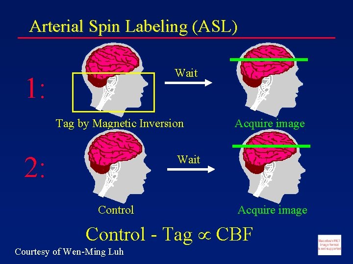 Arterial Spin Labeling (ASL) Wait 1: Tag by Magnetic Inversion 2: Acquire image Wait