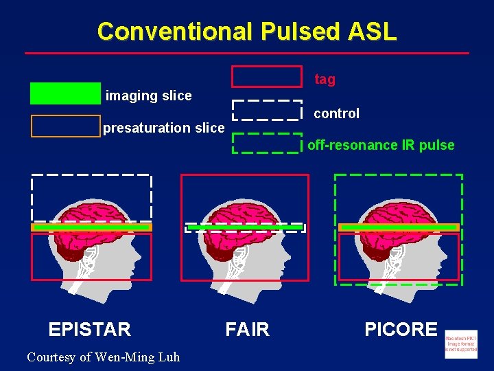 Conventional Pulsed ASL tag imaging slice control presaturation slice off-resonance IR pulse EPISTAR Courtesy