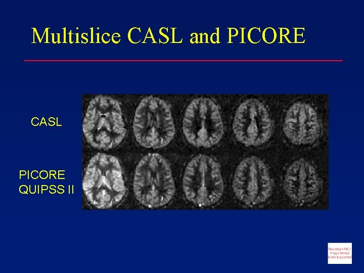 Multislice CASL and PICORE CASL PICORE QUIPSS II 