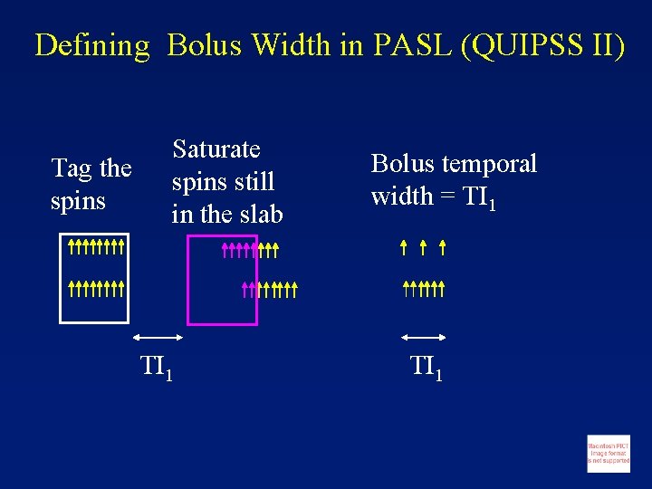 Defining Bolus Width in PASL (QUIPSS II) Tag the spins Saturate spins still in