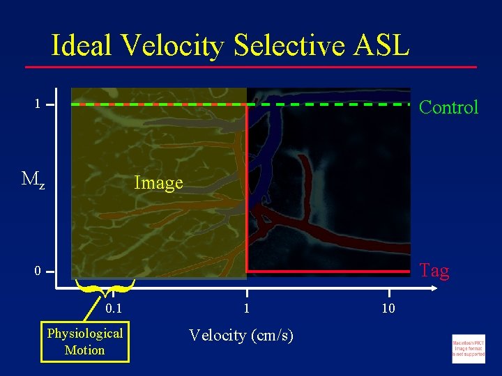 Ideal Velocity Selective ASL 1 Control Mz { 0 Image 0. 1 Physiological Motion