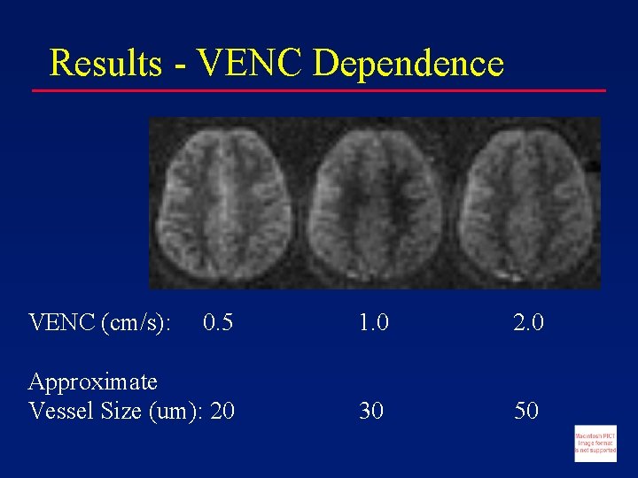 Results - VENC Dependence VENC (cm/s): 0. 5 1. 0 2. 0 Approximate Vessel