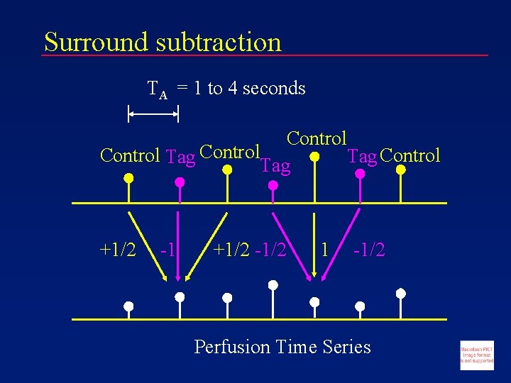 Surround subtraction TA = 1 to 4 seconds Control Tag Tag +1/2 -1/2 1
