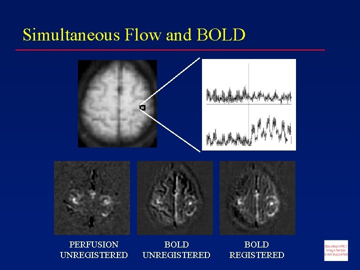 Simultaneous Flow and BOLD PERFUSION UNREGISTERED BOLD REGISTERED 