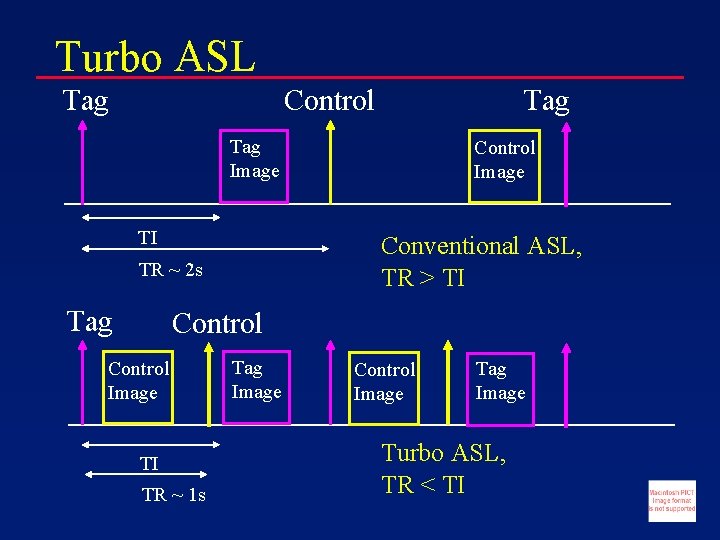 Turbo ASL Tag Control Tag Image TI Conventional ASL, TR > TI TR ~