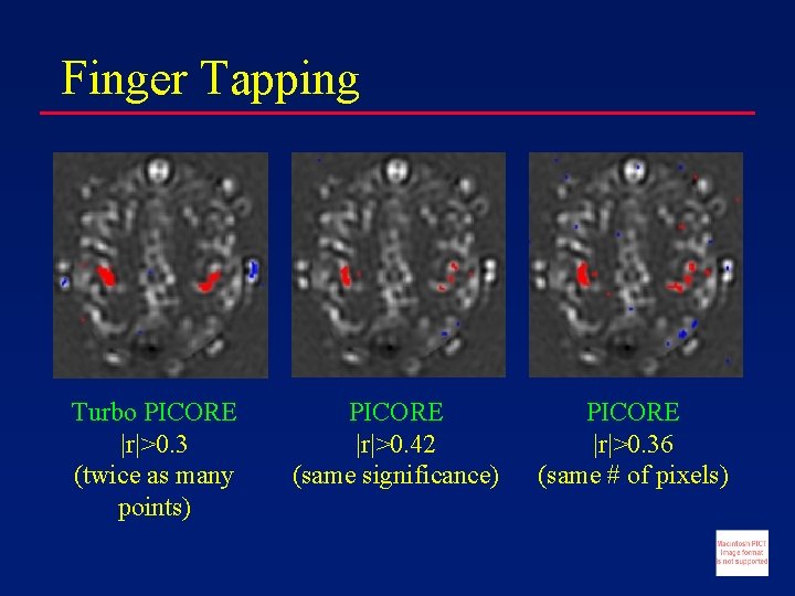 Finger Tapping Turbo PICORE |r|>0. 3 (twice as many points) PICORE |r|>0. 42 (same