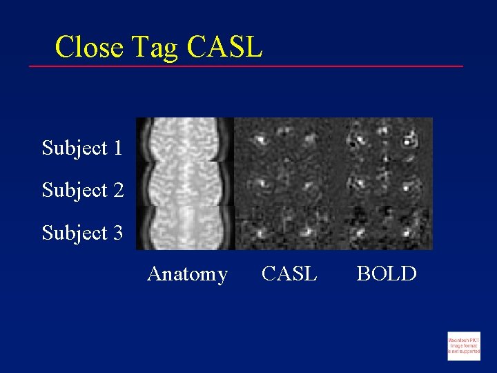 Close Tag CASL Subject 1 Subject 2 Subject 3 Anatomy CASL BOLD 