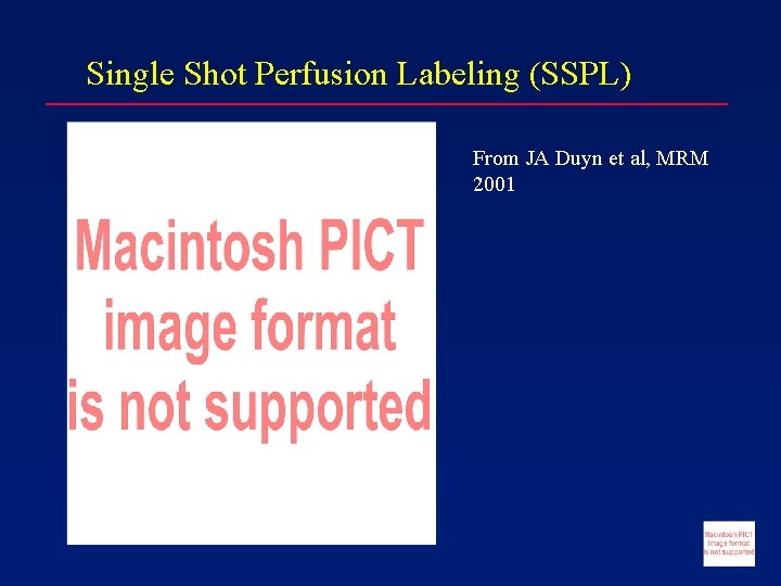 Single Shot Perfusion Labeling (SSPL) From JA Duyn et al, MRM 2001 