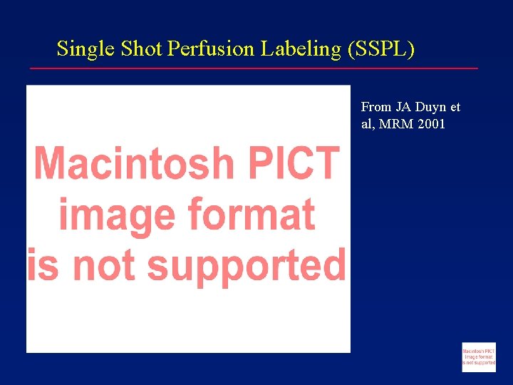 Single Shot Perfusion Labeling (SSPL) From JA Duyn et al, MRM 2001 