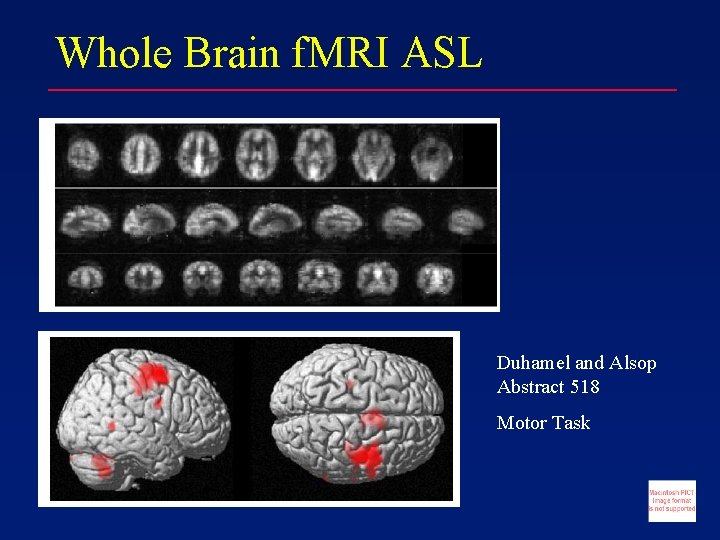 Whole Brain f. MRI ASL Duhamel and Alsop Abstract 518 Motor Task 