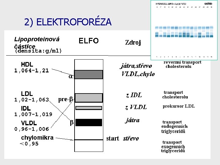 2) ELEKTROFORÉZA 23 